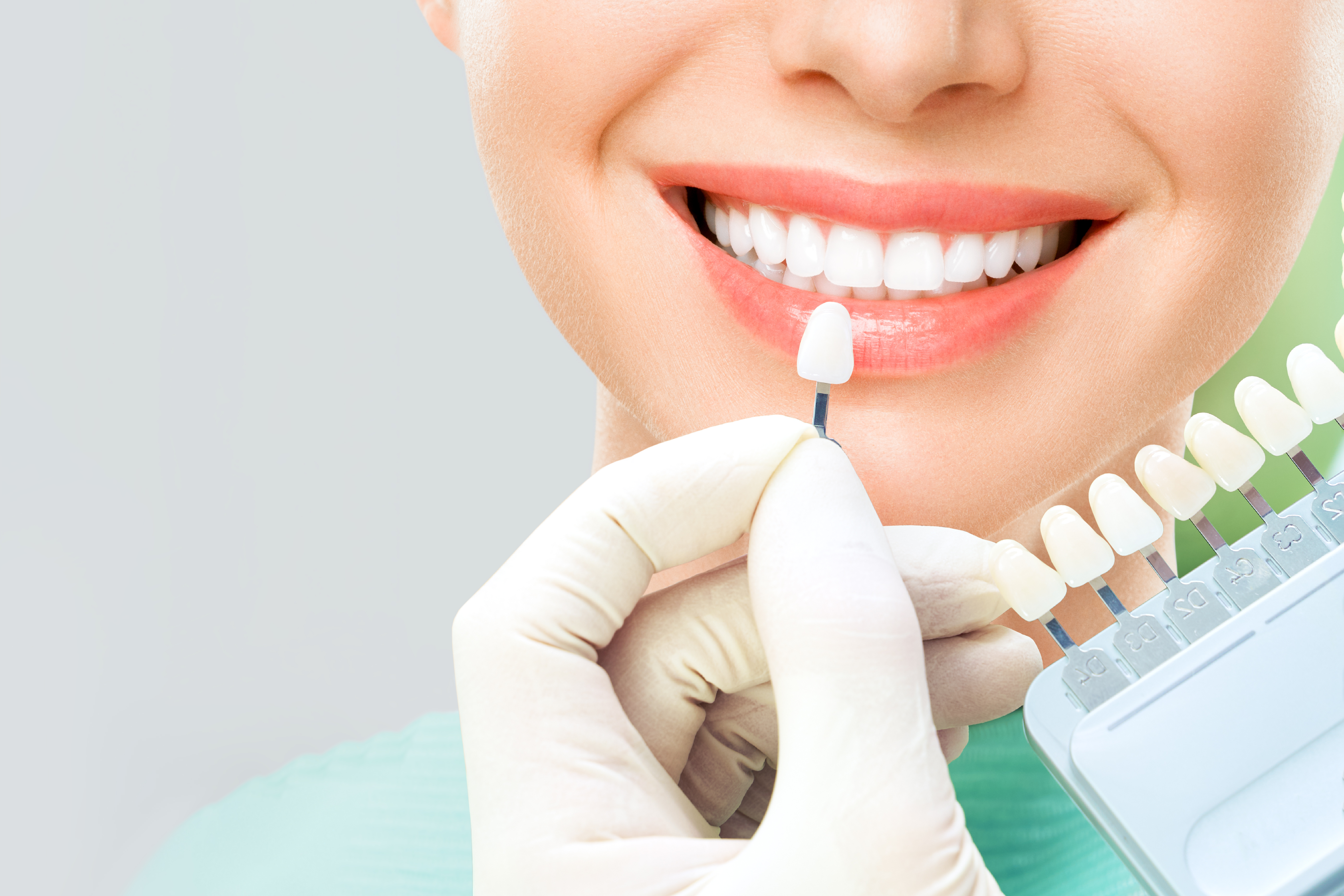 Dental Cleaning