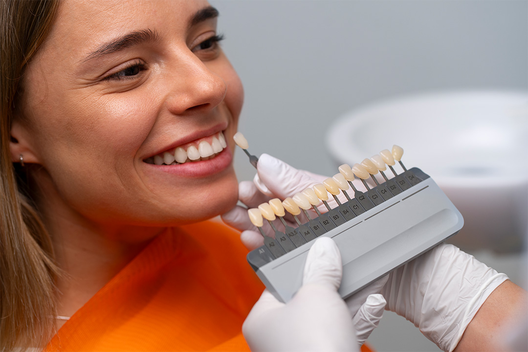 Laminates and Veneers