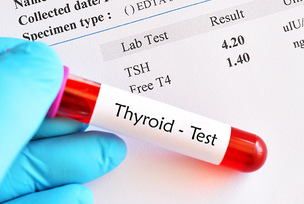 Thyroid Test