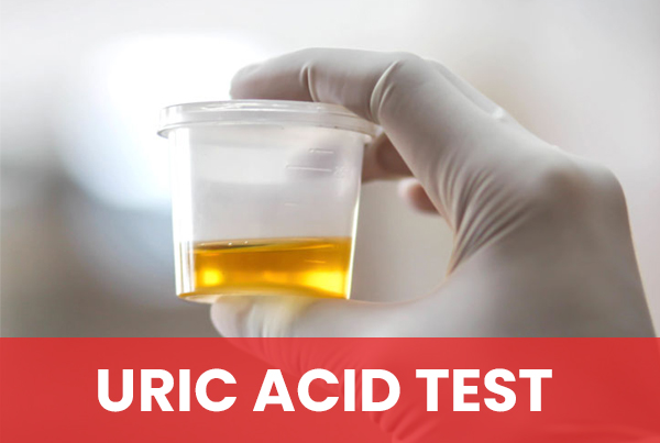 Uric Acid Test