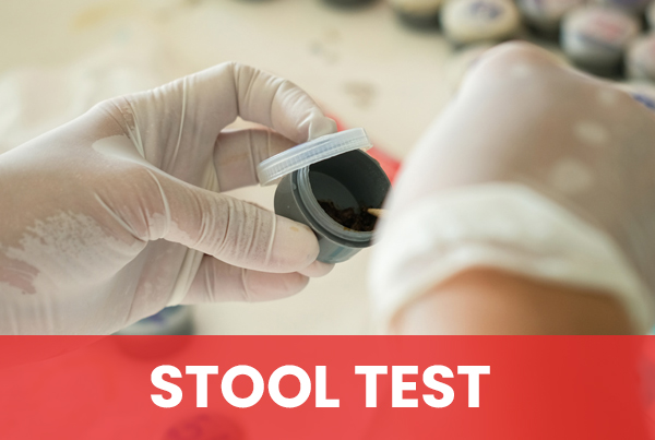 Stool Test