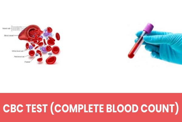 CBC Test