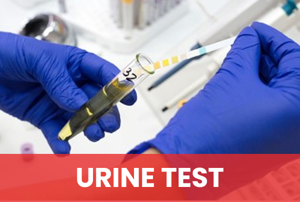 Urine Test