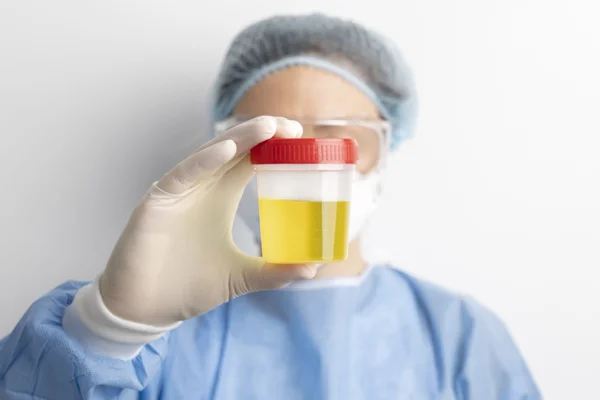 Urine Test