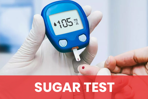 Sugar Test