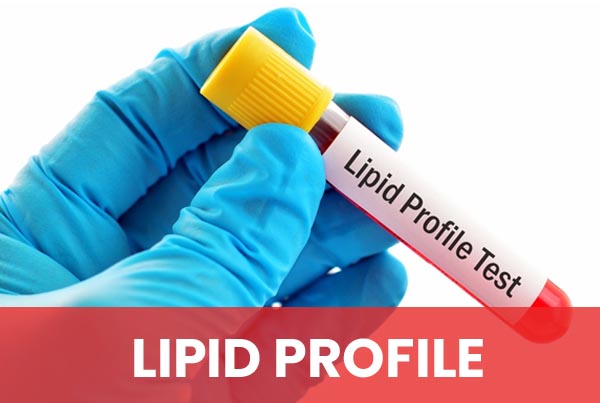 Lipid Test