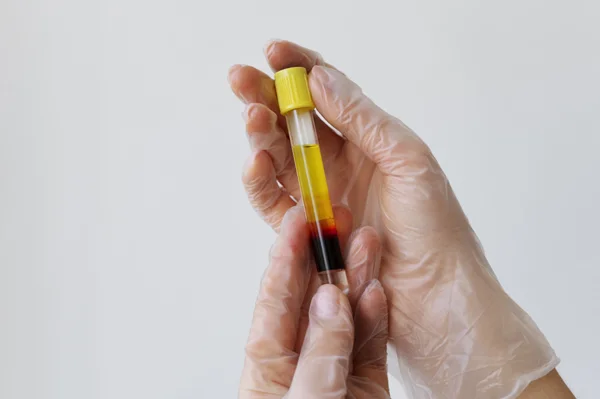 Lipid Test