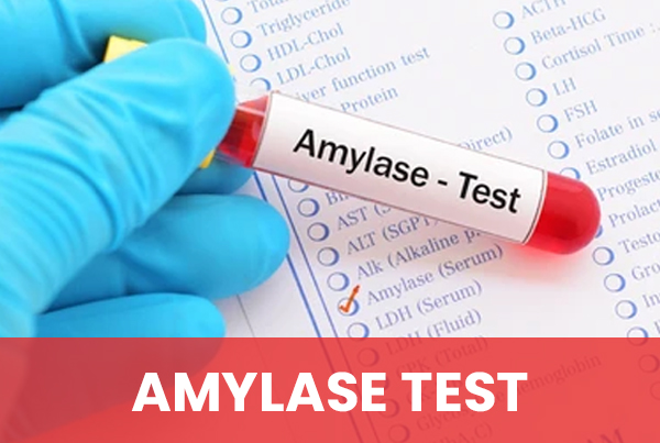 Amylase Test