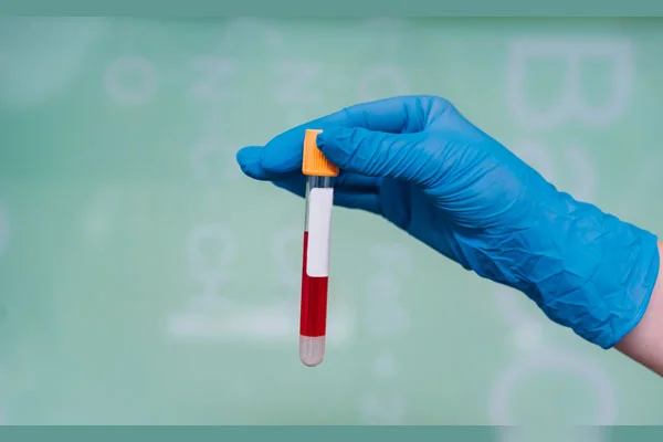 Amylase Test