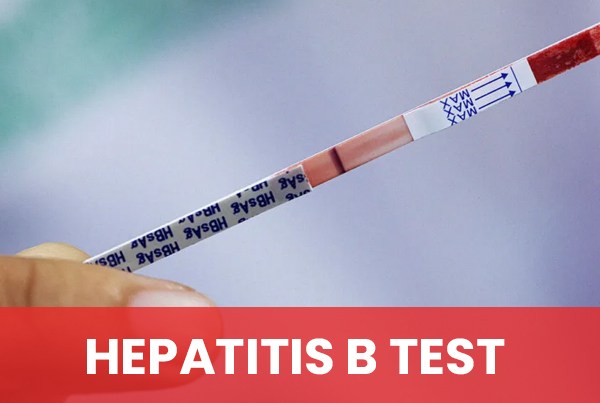 Hepatitis B Test