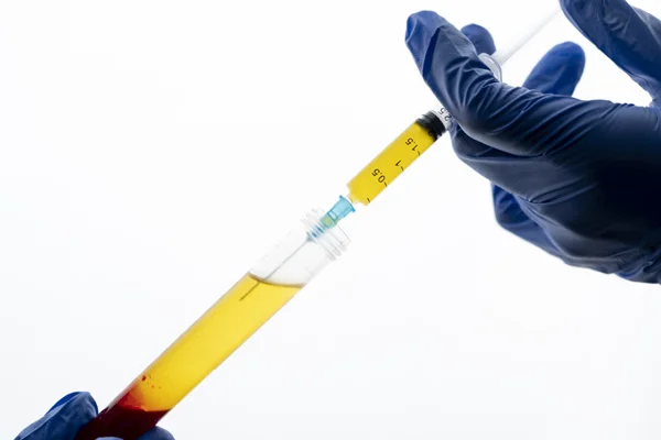 Hepatitis B Test