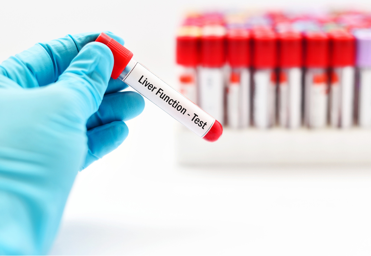 Liver Function Test