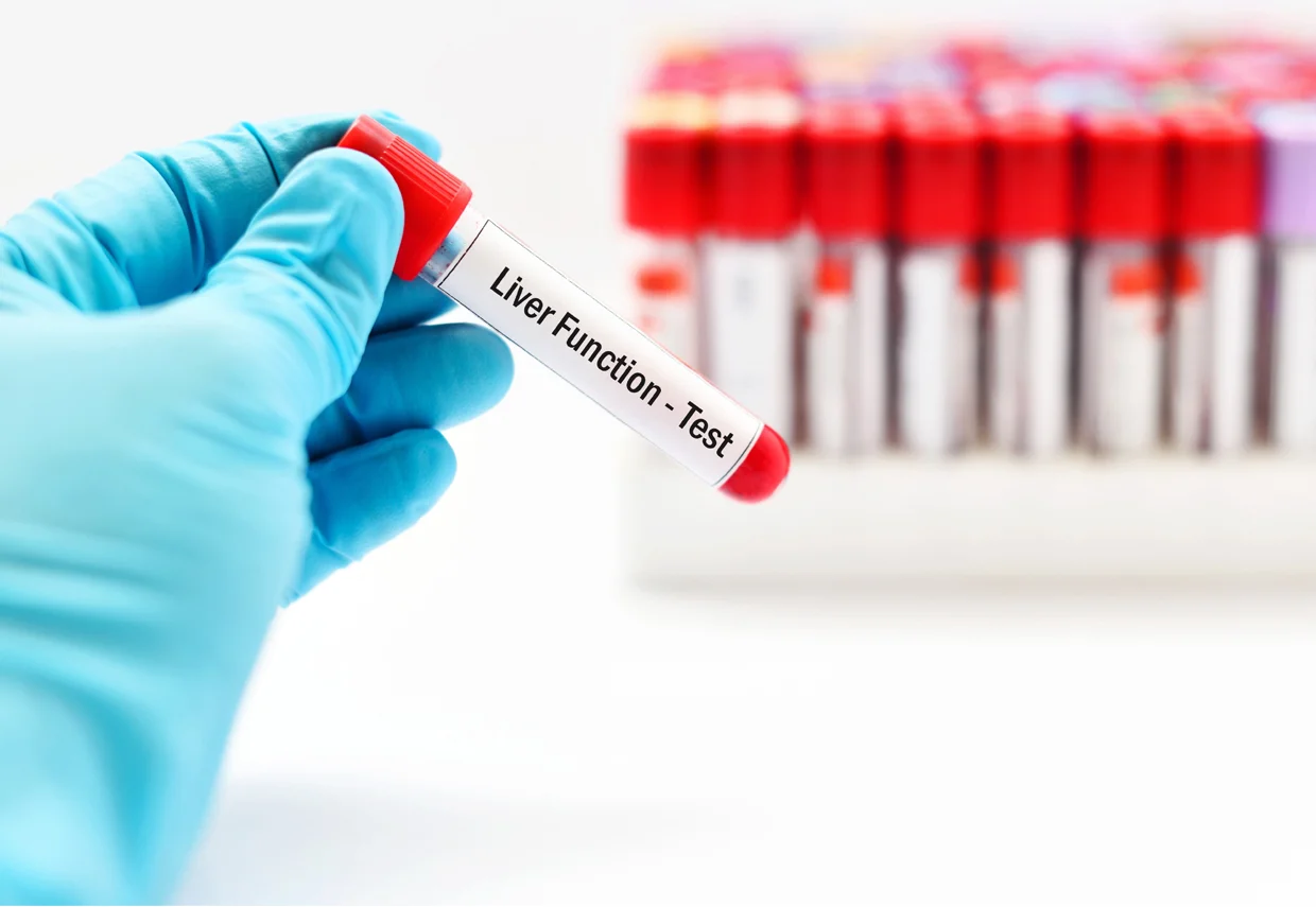 Liver Function Test
