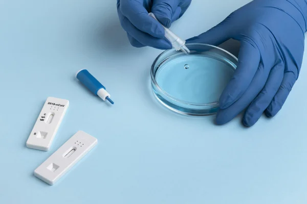 HbsAg Test
