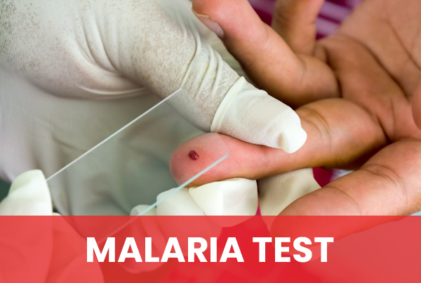 Malaria Test