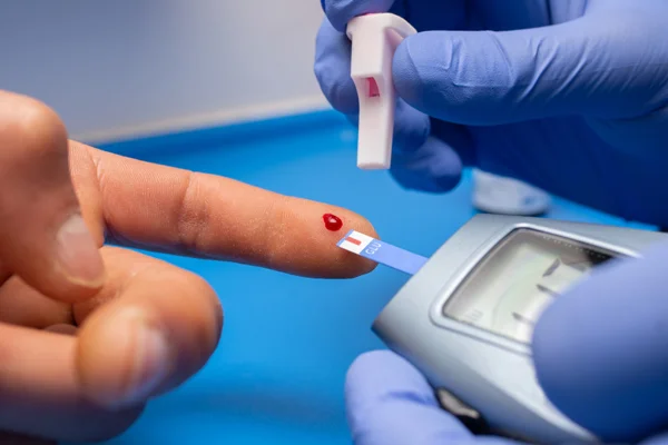 Cholesterol Test